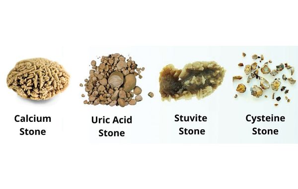 The Impact of Minerals in Water on Your Health: Exploring Evidence